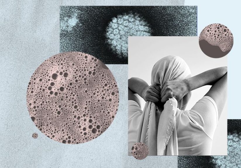 Cancer and HPV: Types, Prevention, and More
