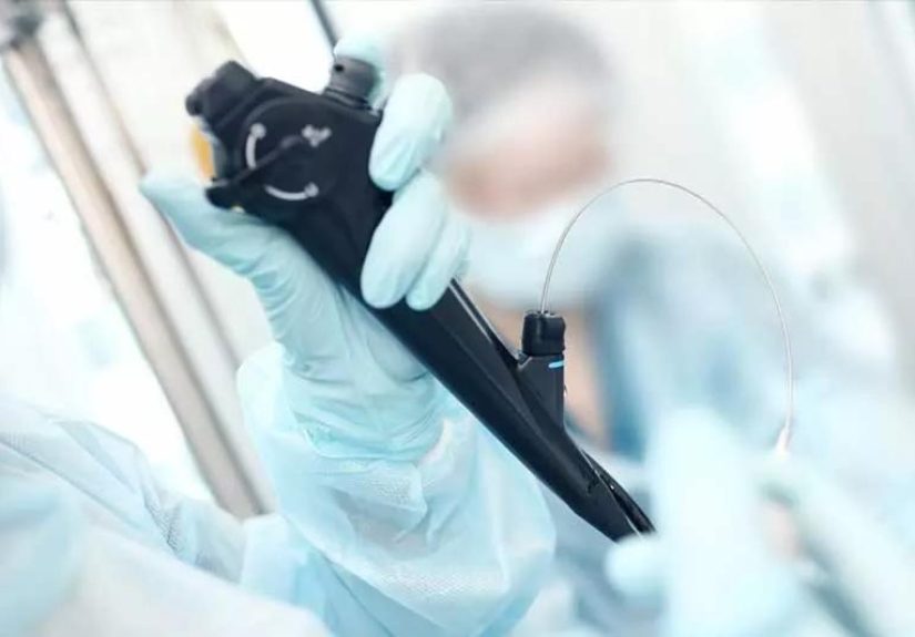 Endoscopy vs. Colonoscopy vs. Sigmoidoscopy