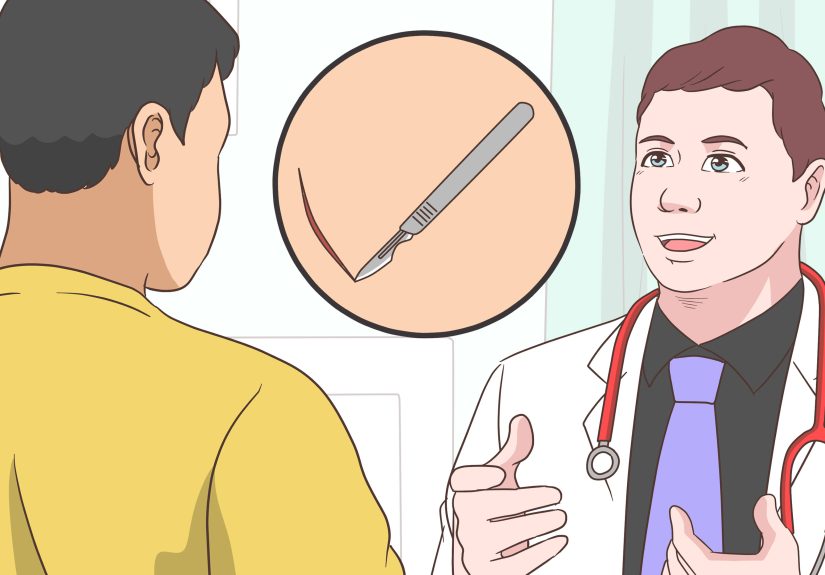 3 Ways to Remove Plaque from Arteries
