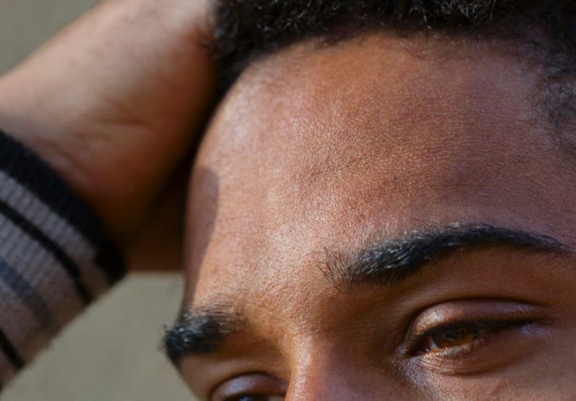 FUT Hair Transplant Procedure: Benefits, Side Effects, How it Works