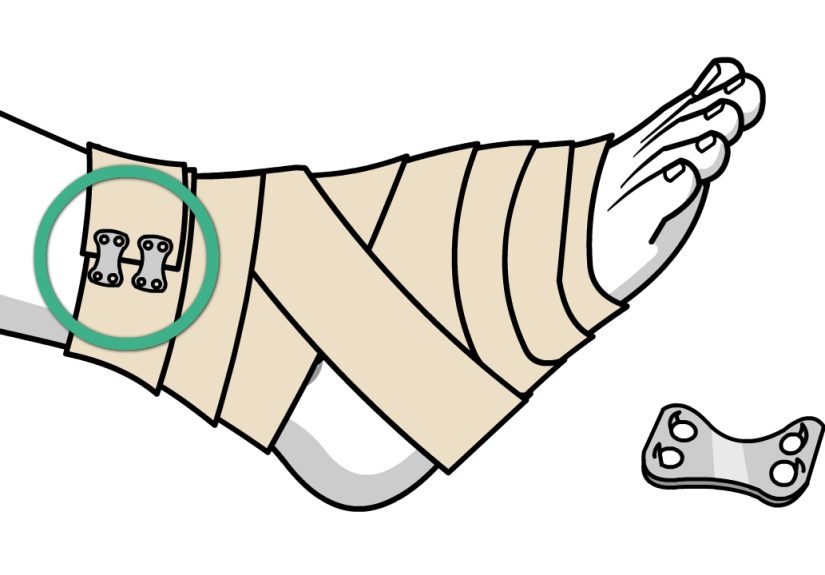 How to Wrap a Sprained Ankle: 14 Steps