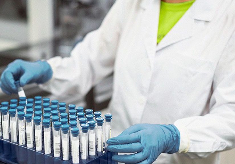 Mixed connective tissue disease: What to know