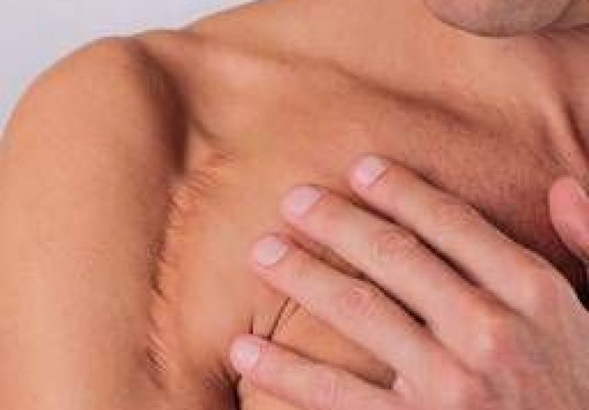 Scars: Are they preventable?