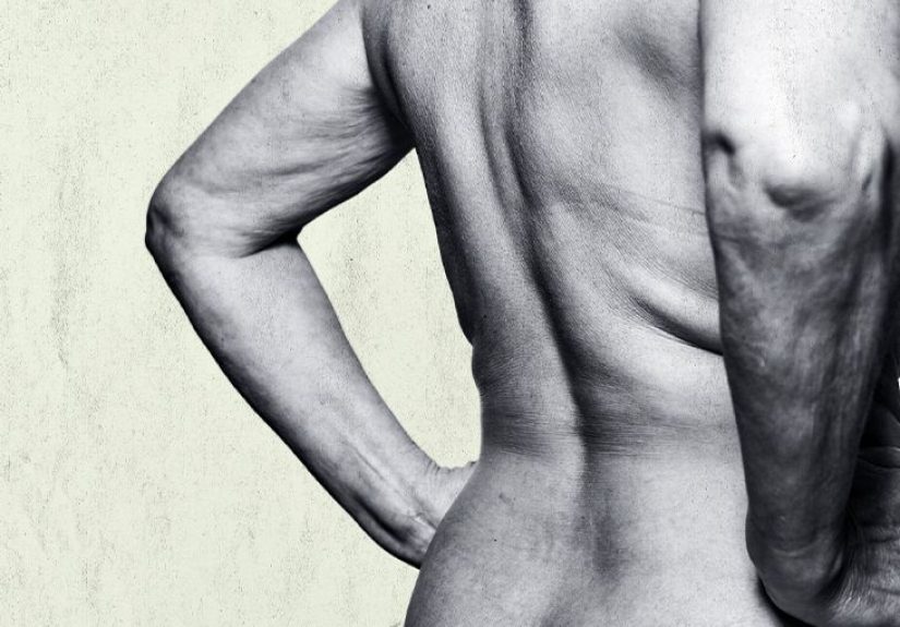 Tingling in the back: Causes, treatment, and prevention