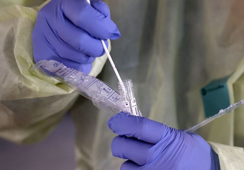 Coronavirus (COVID-19) Tests: Methods, Availability, and Accuracy
