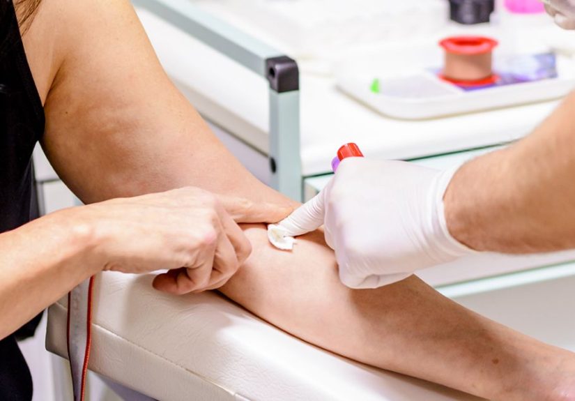 HIV RNA Test: When to Use, How It Works
