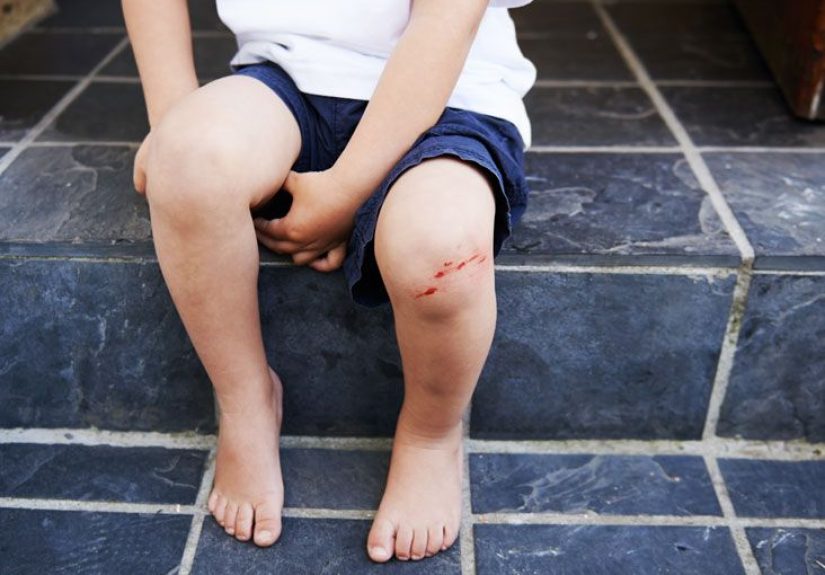 Toxic Synovitis: Causes, Symptoms, and Diagnosis