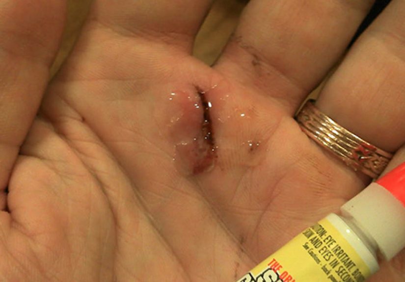 10 Everyday Things That Could Unexpectedly Save Your Life