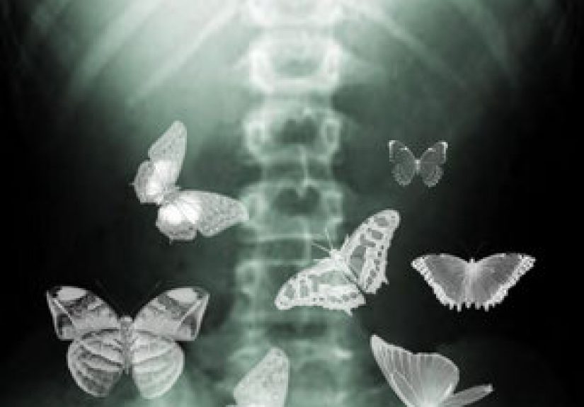 #259 The Good Kind of Stomach Butterflies - 1000 Awesome Things