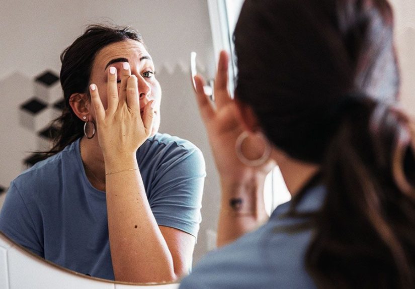 Eyebrow Dandruff: Causes, Treatments, and Remedies