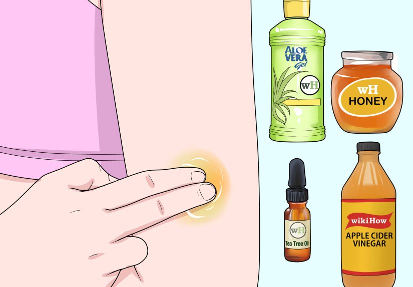 How to Get Rid of a Scab: 9 Steps