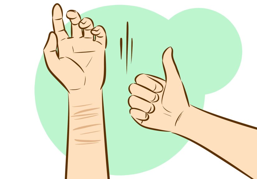 How to Get Rid of Self-Harm Scars: OTC & Medical Options