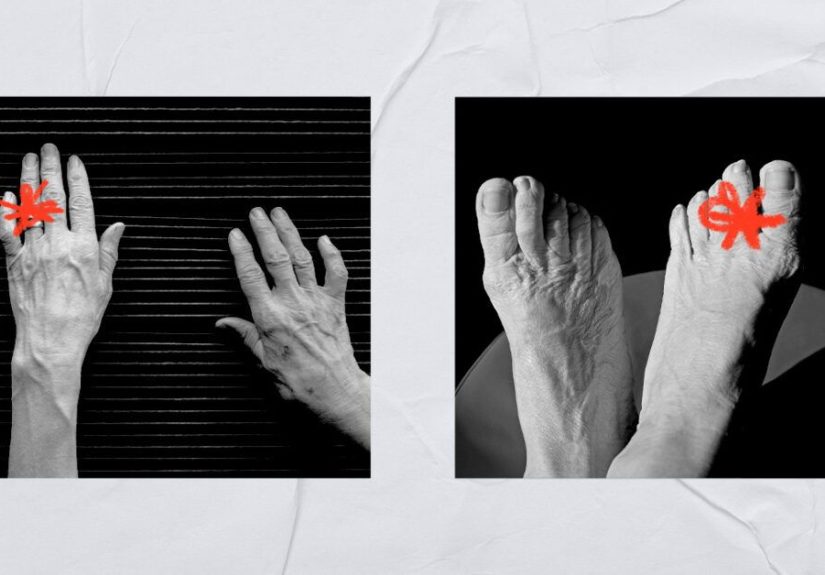 Joints locking up in fingers and toes: Symptoms and more