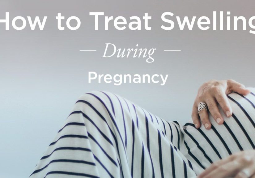 Swollen Hands During Pregnancy: Natural Treatments